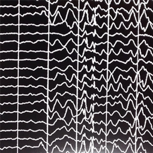 DJ Matuss - Seizure No. 1 - Absence Seizure DJ Matuss - Seizure No. 1 - Absence Seizure