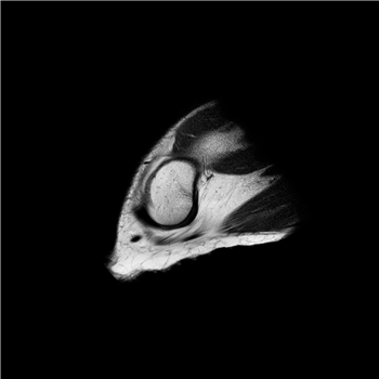 ANTN - All we do is Rolyeplay EP - COUNTERWEIGHT ANTN - All we do is Rolyeplay EP - COUNTERWEIGHT