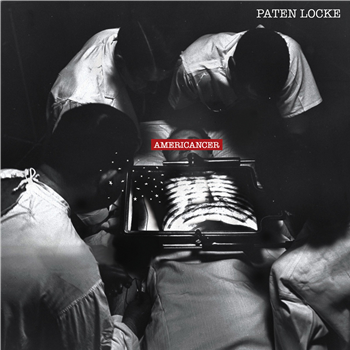 Paten Locke - Americancer - Full Plate
