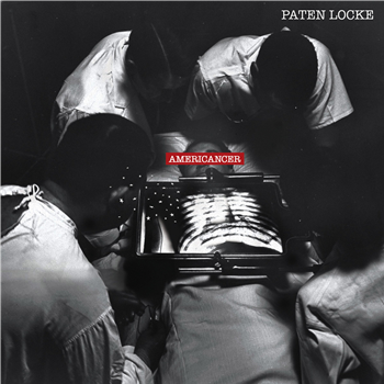 Paten Locke - Americancer - Full Plate Paten Locke - Americancer - Full Plate